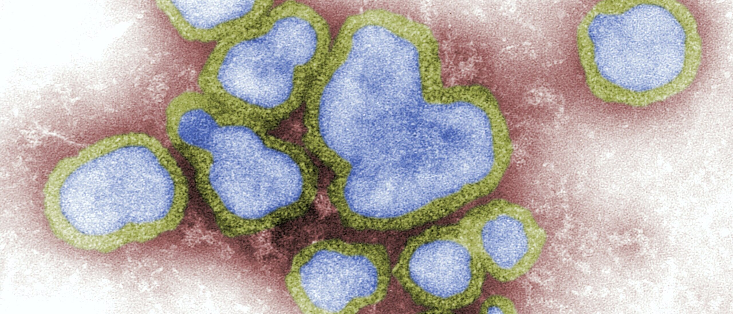 Virus in blau mit gelber Umrandung auf rotem Hintergrund.