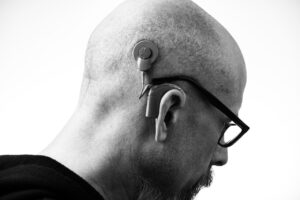 Mann mit Brille, Bart und Cochlea-Implantat am Kopf.